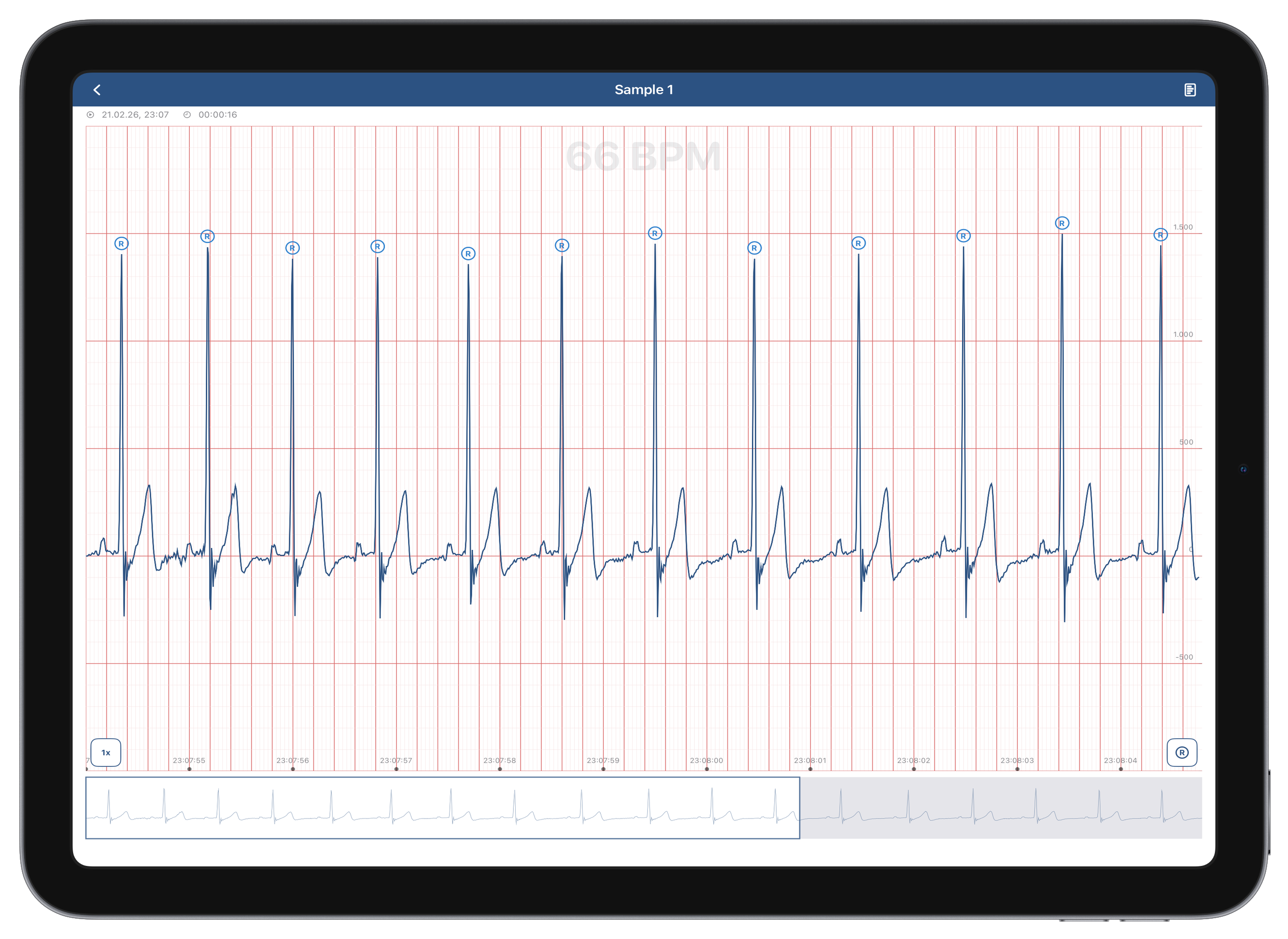 Heart Monitor 24 Analysis View